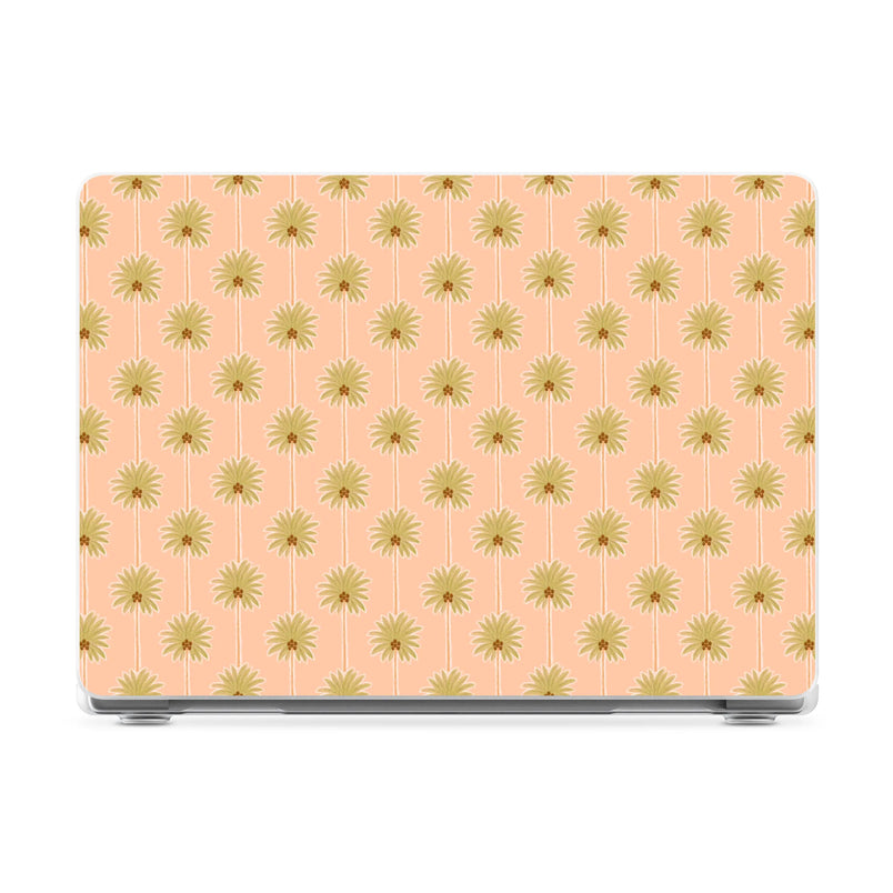 Las Palmeras | Palm Tree Print Laptop Shell - 14" MacBook Pro