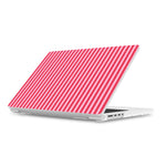 Perfect Stripes | Pink Stripes Laptop Shell