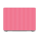 Perfect Stripes | Pink Stripes Laptop Shell - 13" MacBook Neo